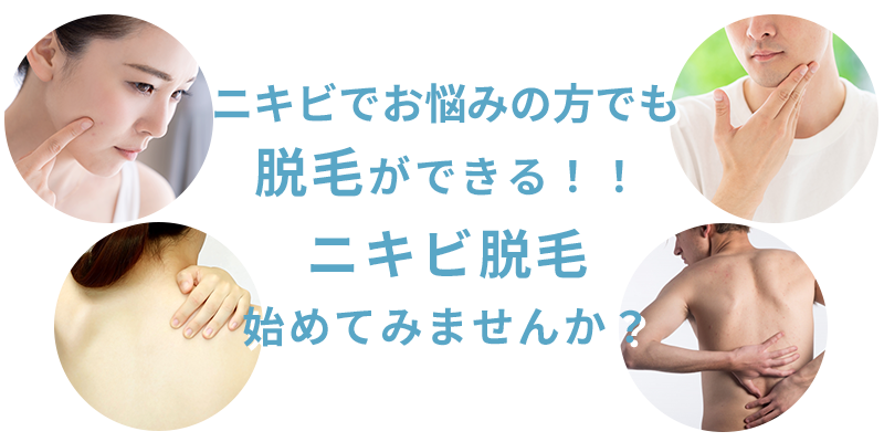 ニキビ脱毛始めてみませんか？