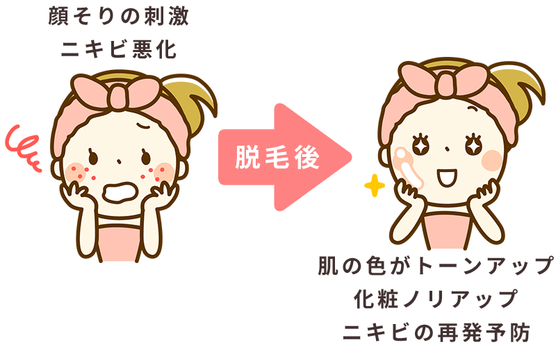 顔剃り、ニキビ予防、トーンアップ、化粧ノリアップ