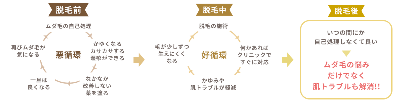 脱毛で悪循環から好循環へ