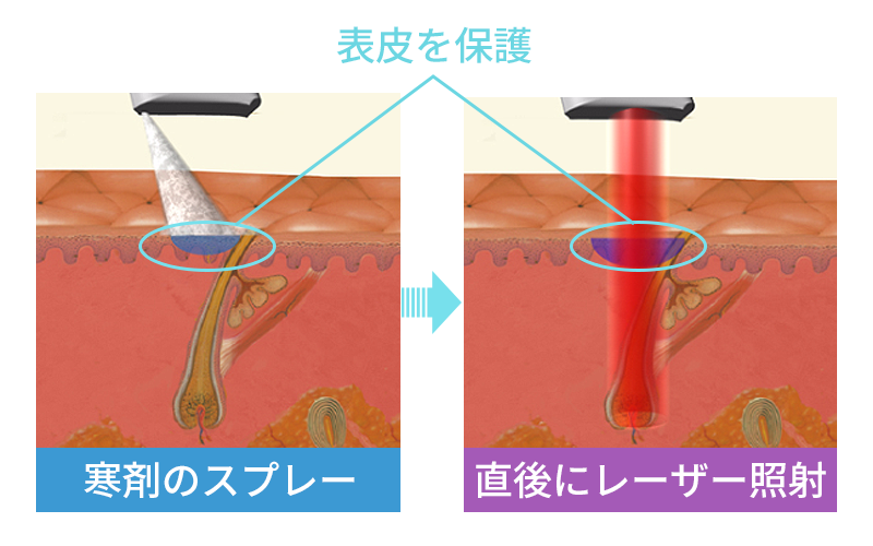 冷却システムDCD