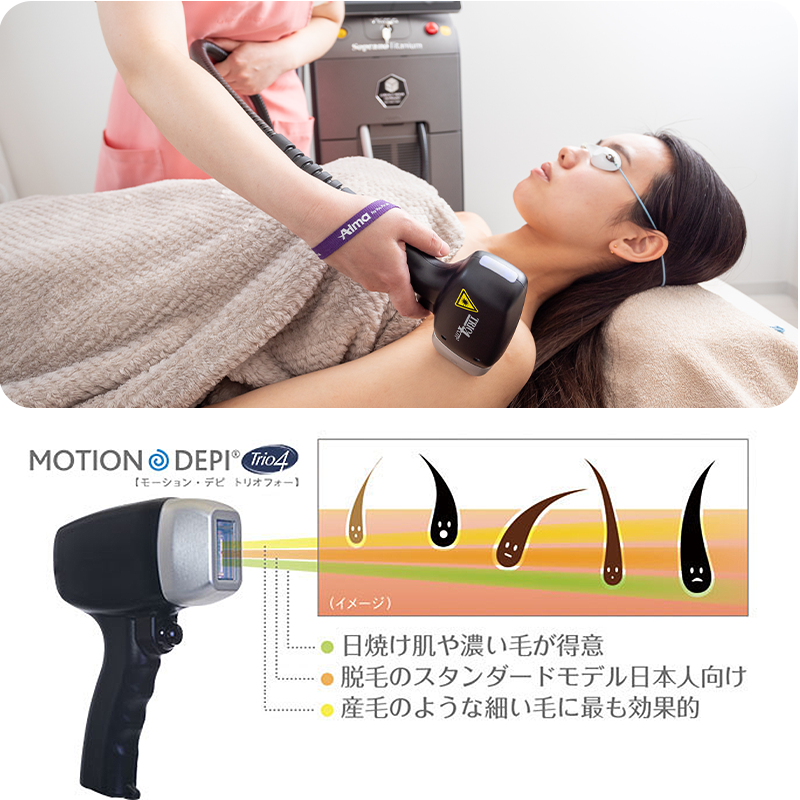 ソプラノアイス