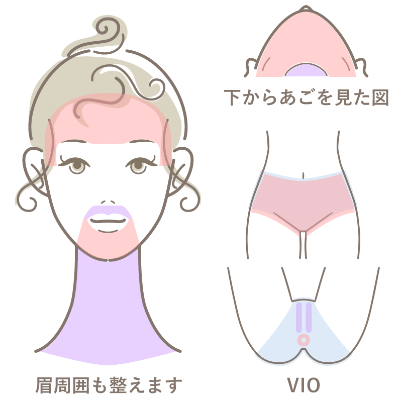 Sパーツ
