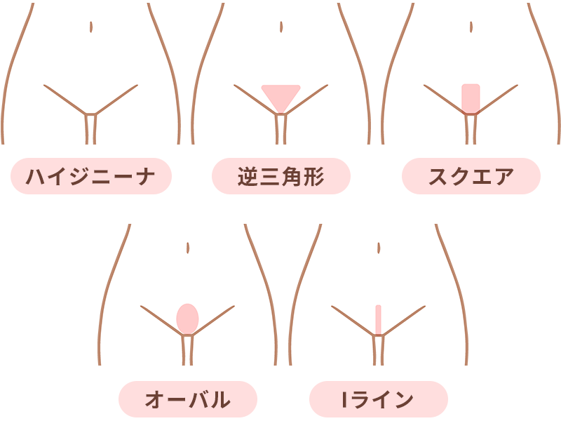 VIOデザイン