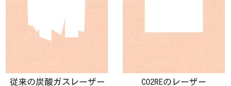 肌の断面