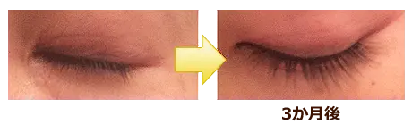作用