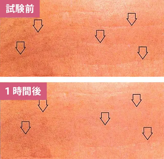 表皮への効果