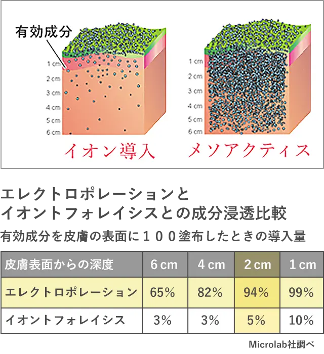 メソアクティスの導入比較