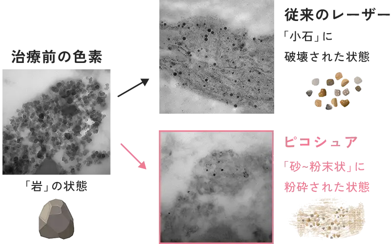 ピコシュア