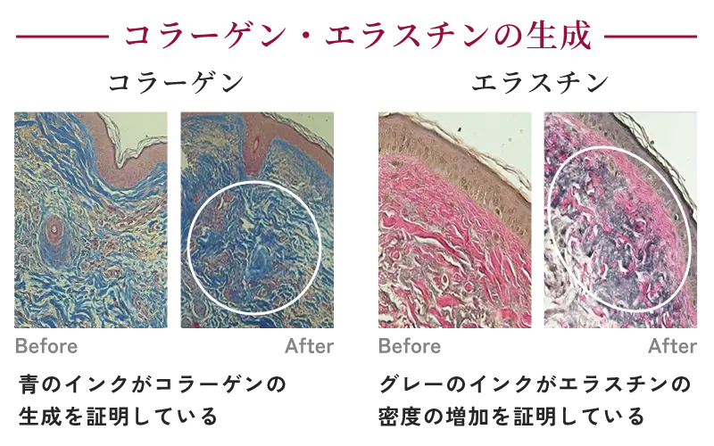 コラーゲン・エラスチン生成