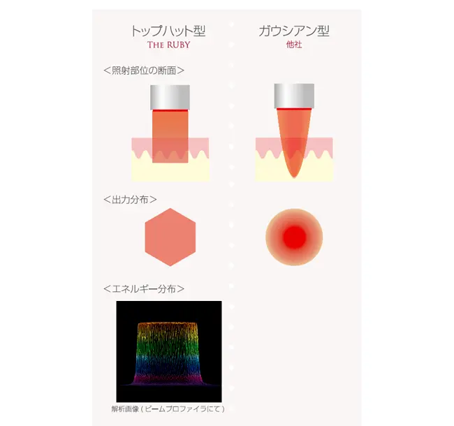 皮膚の奥までムラのないレーザー光