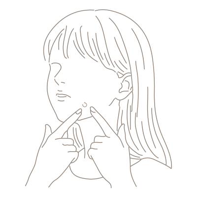 にきび・にきび痕・毛穴