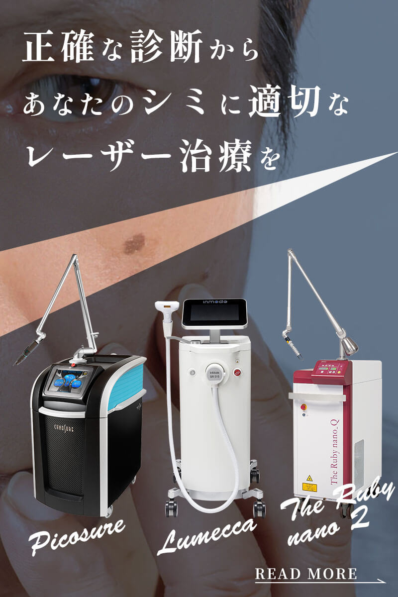 シミ取りレーザー